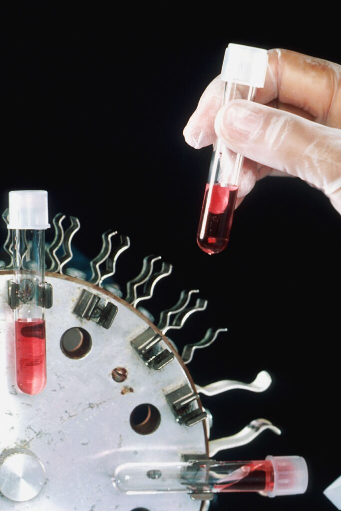 Diagnóstico em Hematologia